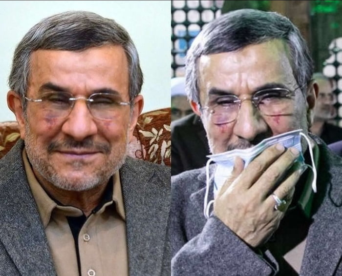 Ahmadinejad has done plastic surgery. Look at his stupid fac