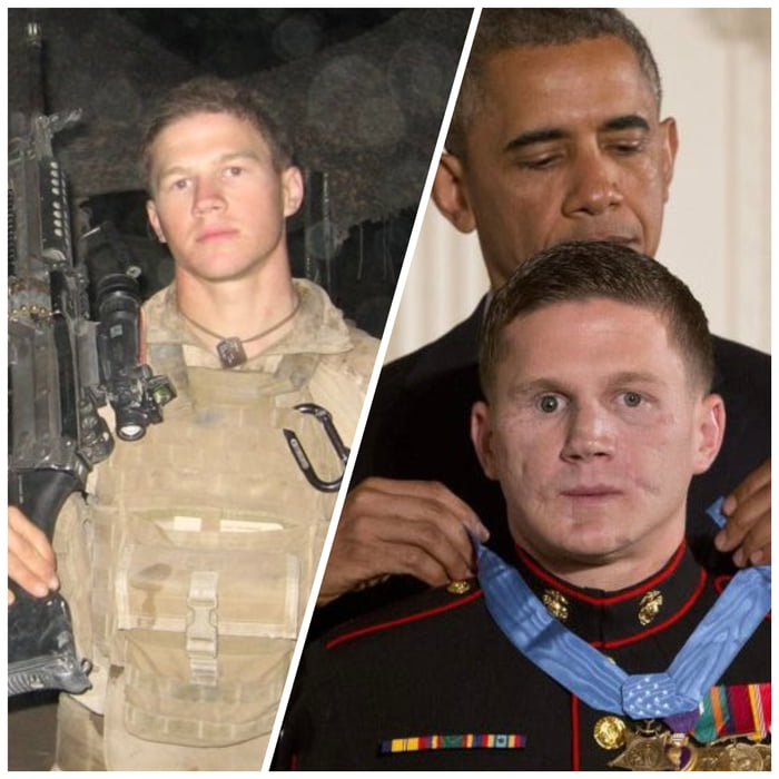 The transformation of Kyle Carpenter before and after sustai