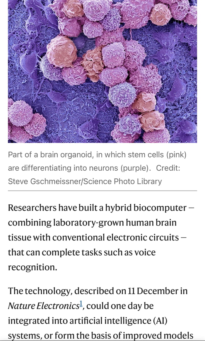 So the computers of the future will be Lab grown brains?